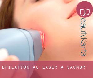 Épilation au laser à Saumur
