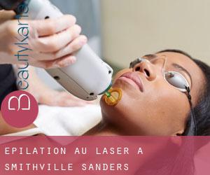 Épilation au laser à Smithville-Sanders