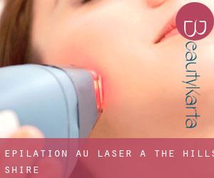 Épilation au laser à The Hills Shire