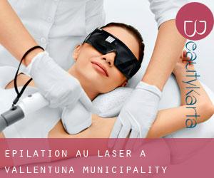 Épilation au laser à Vallentuna Municipality