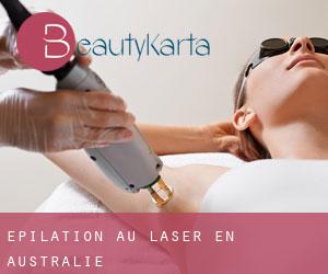 Épilation au laser en Australie Épilation au laser en Australie