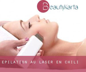 Épilation au laser en Chili Épilation au laser en Chili
