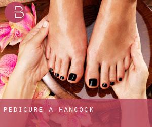 Pédicure à Hancock Pédicure à Hancock