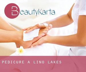 Pédicure à Lino Lakes